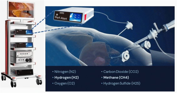 Visualization of Perf-Alert®